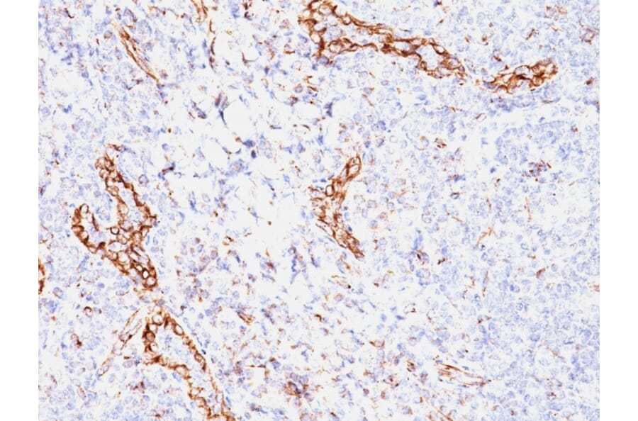 Immunohistochemistry - Anti-VEGF Antibody [VEGF/1063] - BSA and Azide free (A253472) - Antibodies.com