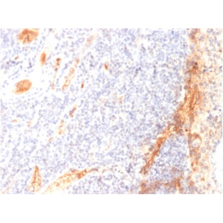 Immunohistochemistry - Anti-VEGF Antibody [VG1] - BSA and Azide free (A253473) - Antibodies.com
