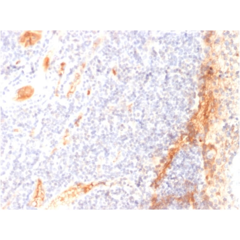 Immunohistochemistry - Anti-VEGF Antibody [VG1] - BSA and Azide free (A253473) - Antibodies.com