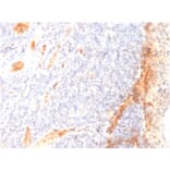 Immunohistochemistry - Anti-VEGF Antibody [VG1] - BSA and Azide free (A253473) - Antibodies.com