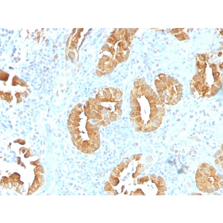 Immunohistochemistry - Anti-Villin Antibody [VIL1/1314] - BSA and Azide free (A253476) - Antibodies.com