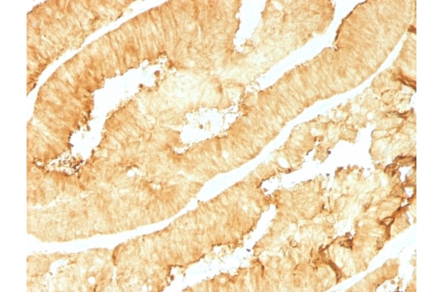 Immunohistochemistry - Anti-Villin Antibody [VIL1/1314] - BSA and Azide free (A253475) - Antibodies.com