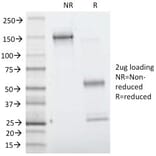 SDS-PAGE - Anti-Villin Antibody [VIL1/1314] - BSA and Azide free (A253476) - Antibodies.com