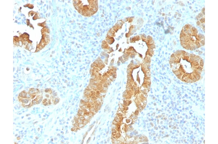 Immunohistochemistry - Anti-Villin Antibody [VIL1/1325] - BSA and Azide free (A253477) - Antibodies.com