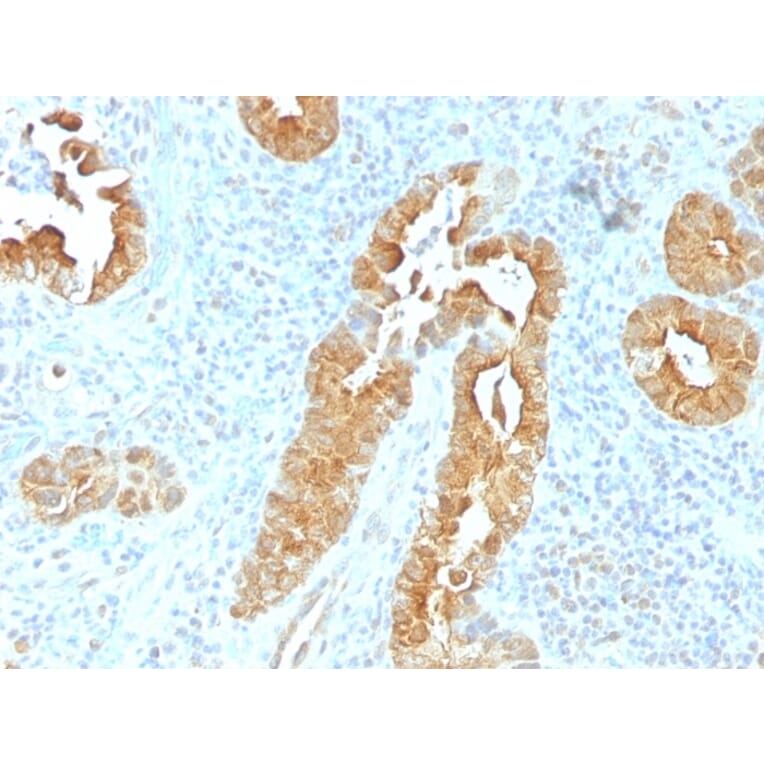 Immunohistochemistry - Anti-Villin Antibody [VIL1/1325] - BSA and Azide free (A253477) - Antibodies.com