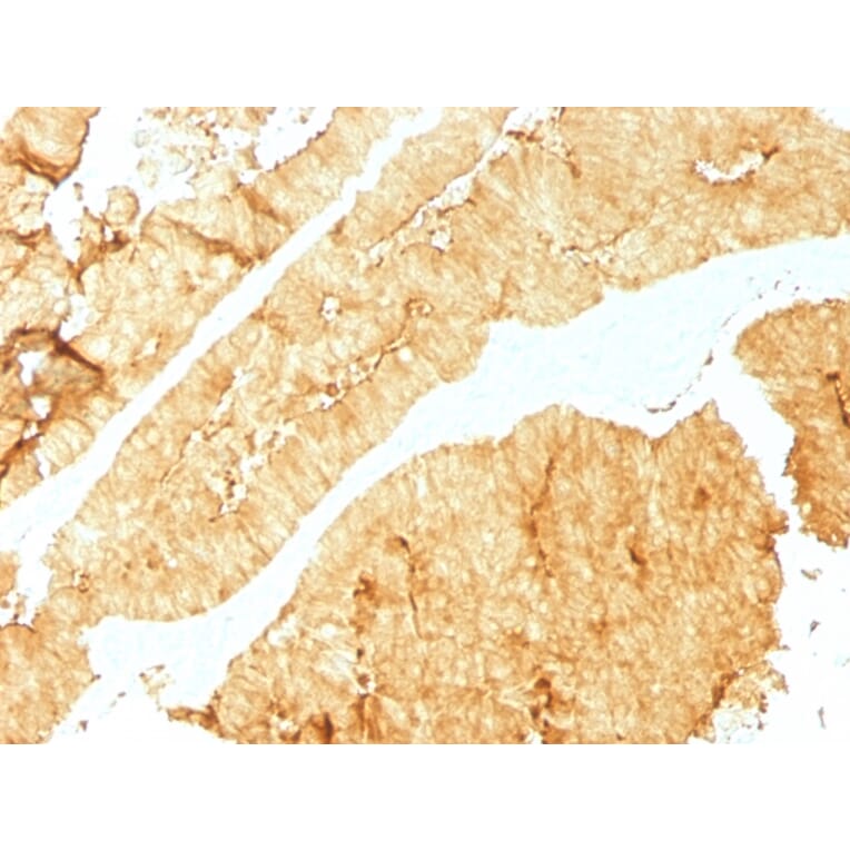 Immunohistochemistry - Anti-Villin Antibody [VIL1/1325] - BSA and Azide free (A253476) - Antibodies.com