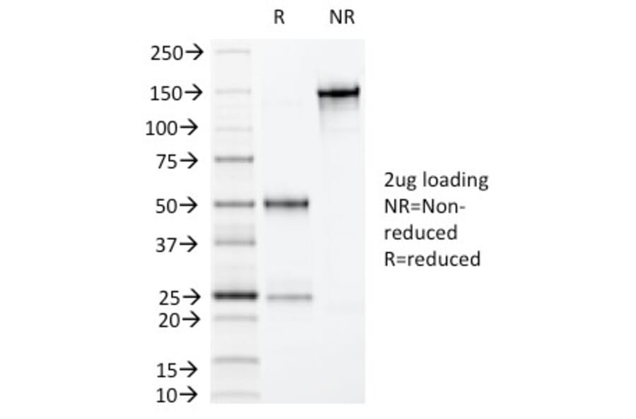 SDS-PAGE - Anti-Villin Antibody [VIL1/1325] - BSA and Azide free (A253477) - Antibodies.com