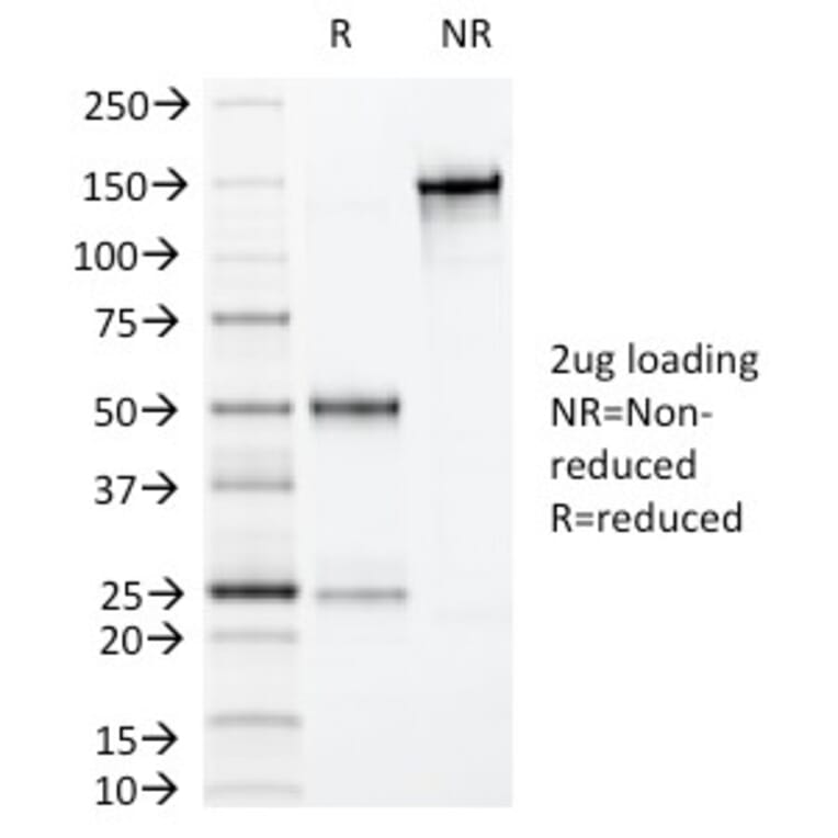 SDS-PAGE - Anti-Villin Antibody [VIL1/1325] - BSA and Azide free (A253477) - Antibodies.com