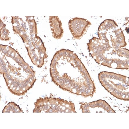 Immunohistochemistry - Anti-Villin Antibody [VIL1/1314 + VIL1/2376] - BSA and Azide free (A253478) - Antibodies.com