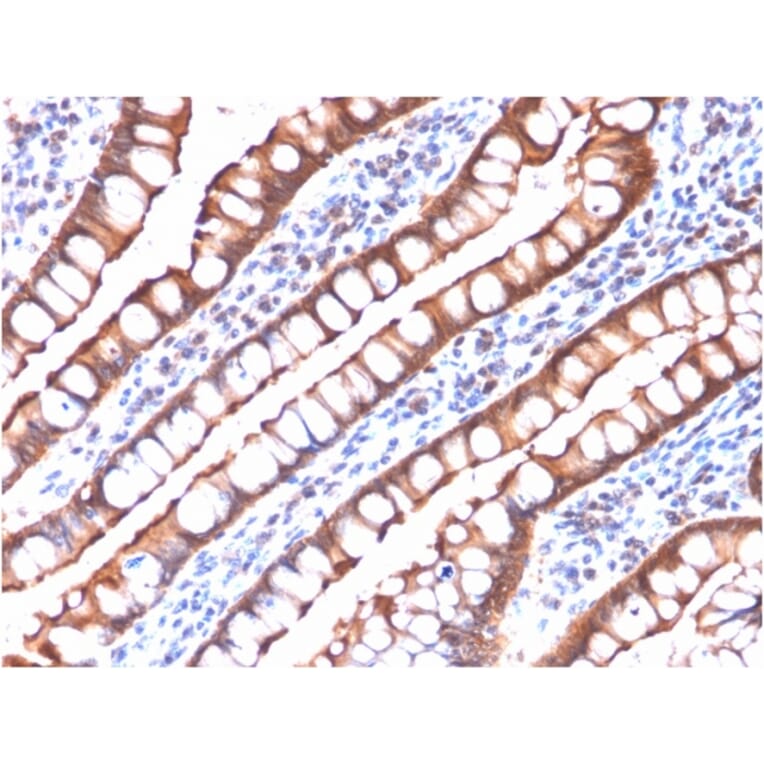 Immunohistochemistry - Anti-Villin Antibody [rVIL1/1325] - BSA and Azide free (A253478) - Antibodies.com