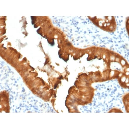 Immunohistochemistry - Anti-Villin Antibody [VIL1/2376] - BSA and Azide free (A253479) - Antibodies.com