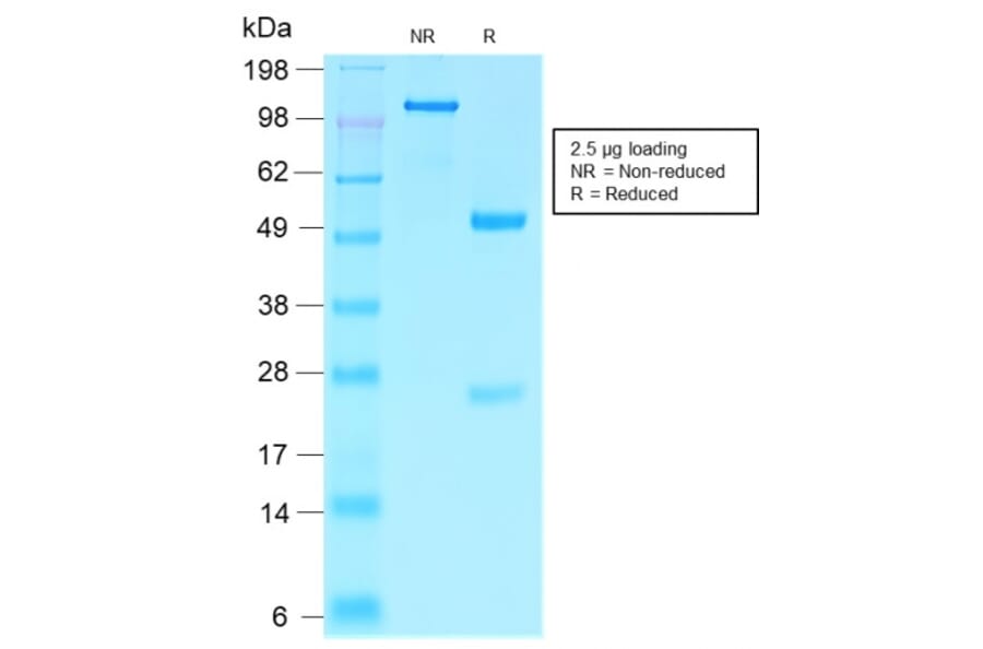 SDS-PAGE - Anti-Villin Antibody [VIL1/2310R] - BSA and Azide free (A253481) - Antibodies.com