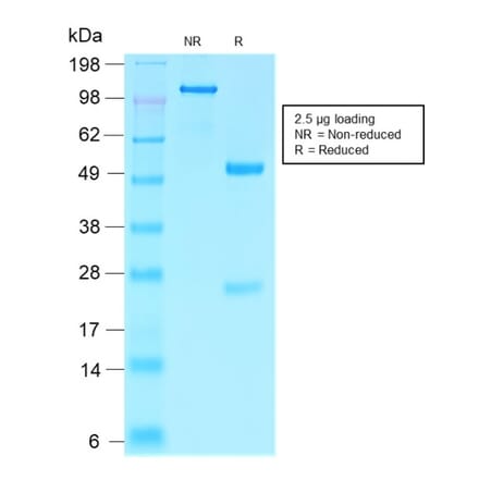 SDS-PAGE - Anti-Villin Antibody [VIL1/2310R] - BSA and Azide free (A253481) - Antibodies.com