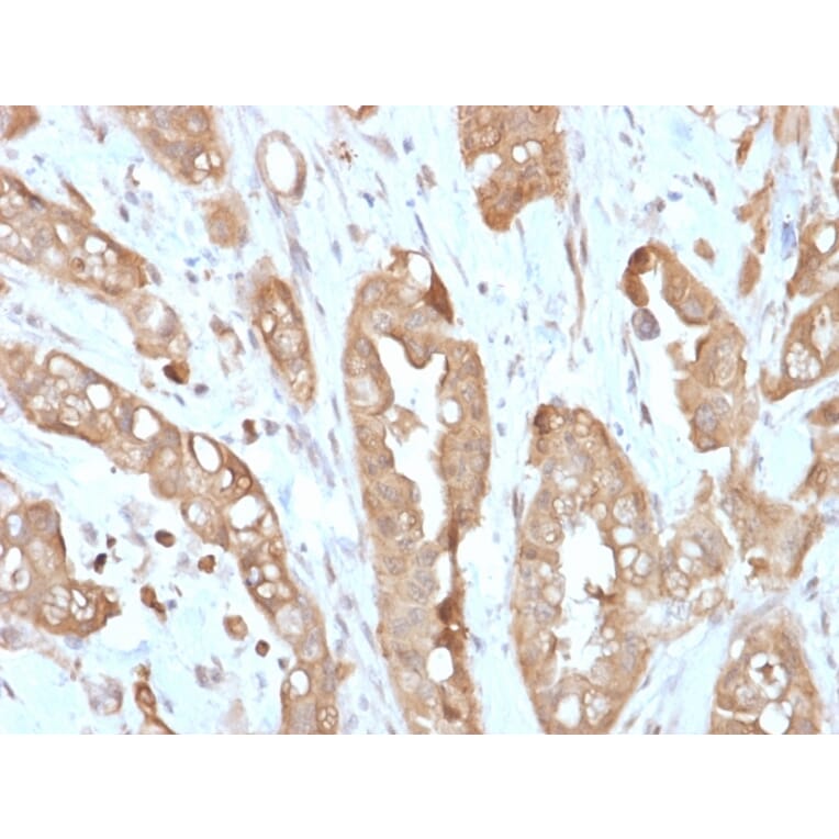 Immunohistochemistry - Anti-Villin Antibody [VIL1/2310R] - BSA and Azide free (A253480) - Antibodies.com