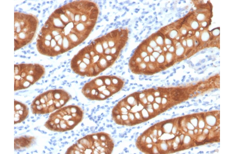 Immunohistochemistry - Anti-Villin Antibody [VIL1/4107R] - BSA and Azide free (A253482) - Antibodies.com