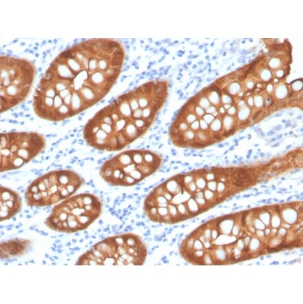 Immunohistochemistry - Anti-Villin Antibody [VIL1/4107R] - BSA and Azide free (A253482) - Antibodies.com