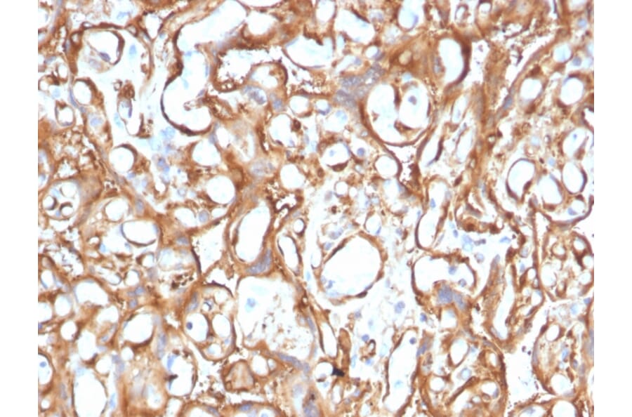 Immunohistochemistry - Anti-Ezrin Antibody [CPTC-Ezrin-1] - BSA and Azide free (A253483) - Antibodies.com