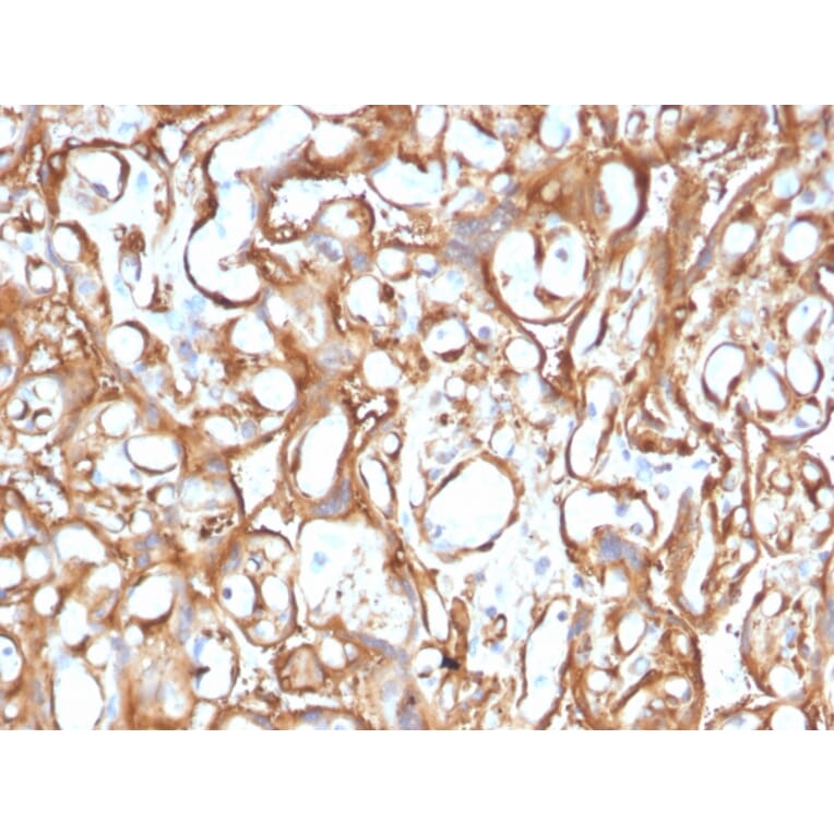 Immunohistochemistry - Anti-Ezrin Antibody [CPTC-Ezrin-1] - BSA and Azide free (A253483) - Antibodies.com