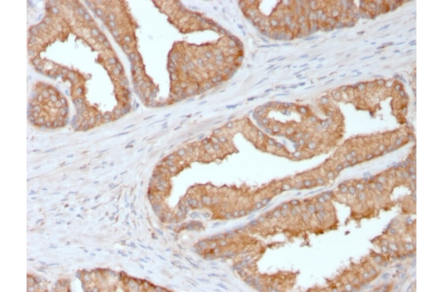 Immunohistochemistry - Anti-Ezrin Antibody [CPTC-Ezrin-1] - BSA and Azide free (A253483) - Antibodies.com