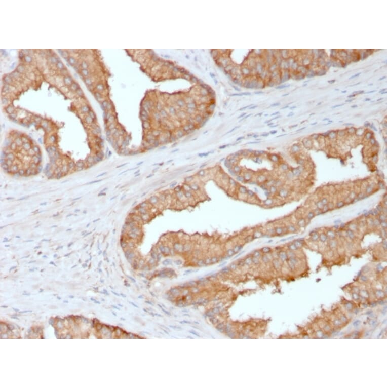 Immunohistochemistry - Anti-Ezrin Antibody [CPTC-Ezrin-1] - BSA and Azide free (A253483) - Antibodies.com