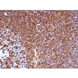 Immunohistochemistry - Anti-Vimentin Antibody [rVIM/6431] - BSA and Azide free (A253485) - Antibodies.com