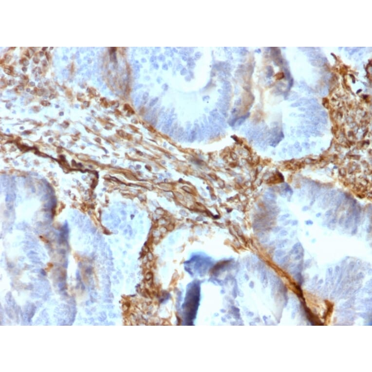 Immunohistochemistry - Anti-Vimentin Antibody [rVIM/6431] - BSA and Azide free (A253484) - Antibodies.com