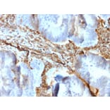 Immunohistochemistry - Anti-Vimentin Antibody [rVIM/6431] - BSA and Azide free (A253484) - Antibodies.com