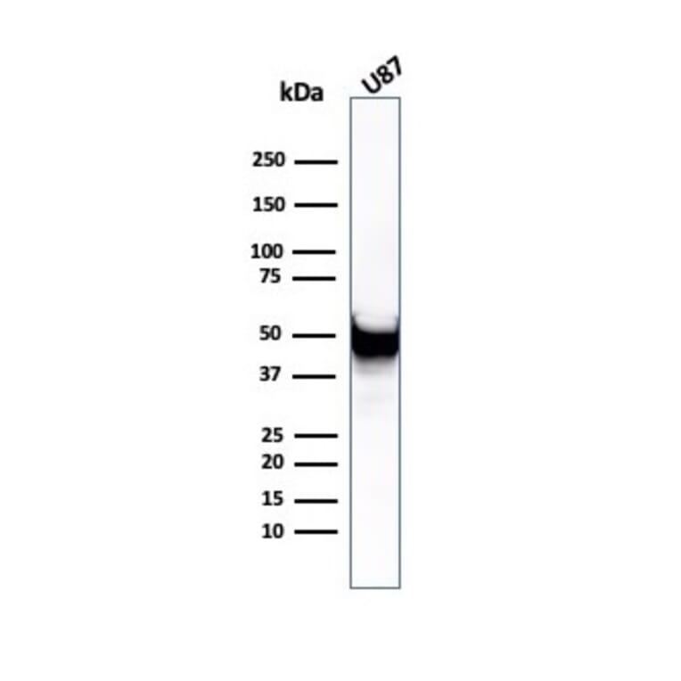 Western Blot - Anti-Vimentin Antibody [rVIM/6431] - BSA and Azide free (A253485) - Antibodies.com