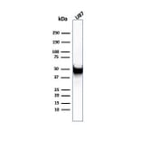 Western Blot - Anti-Vimentin Antibody [rVIM/6431] - BSA and Azide free (A253485) - Antibodies.com