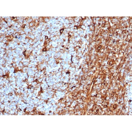Immunohistochemistry - Anti-Vimentin Antibody [rVIM/6575] - BSA and Azide free (A253486) - Antibodies.com