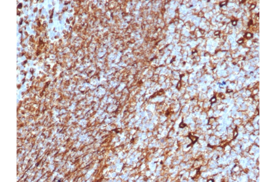 Immunohistochemistry - Anti-Vimentin Antibody [rVIM/6575] - BSA and Azide free (A253485) - Antibodies.com