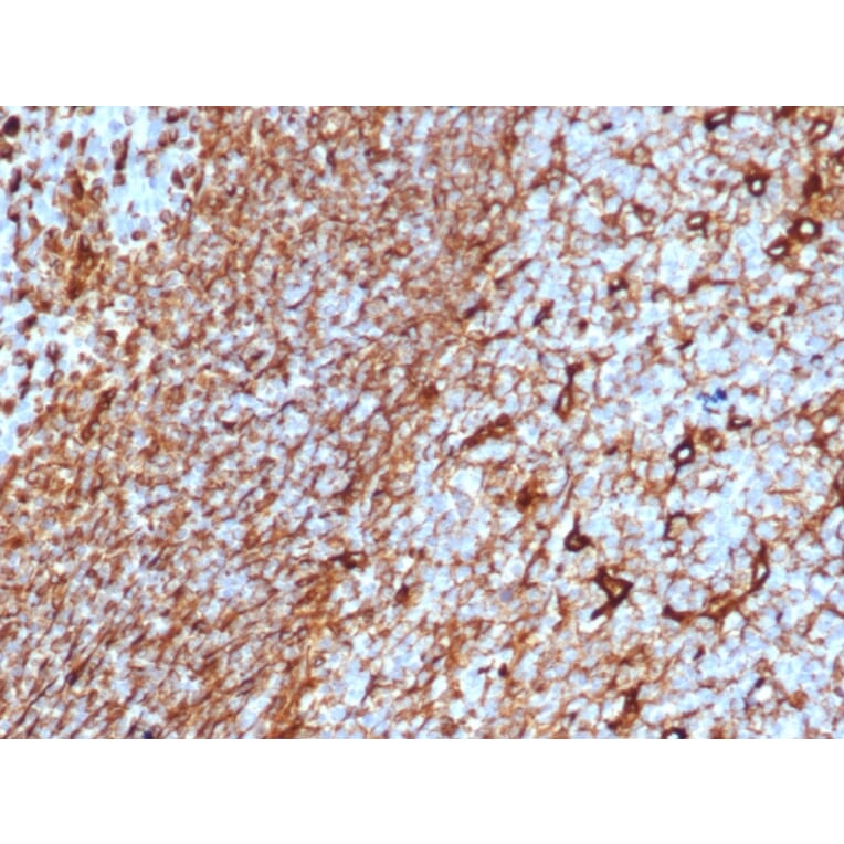 Immunohistochemistry - Anti-Vimentin Antibody [rVIM/6575] - BSA and Azide free (A253485) - Antibodies.com