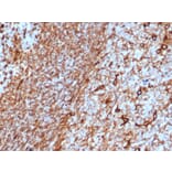 Immunohistochemistry - Anti-Vimentin Antibody [rVIM/6575] - BSA and Azide free (A253485) - Antibodies.com