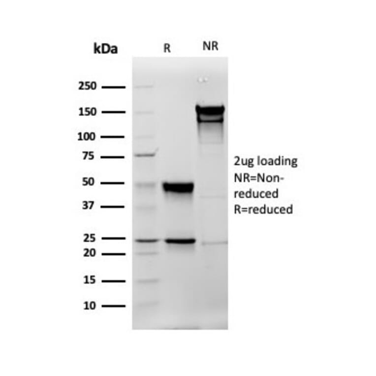 SDS-PAGE - Anti-Vimentin Antibody [rVIM/6575] - BSA and Azide free (A253486) - Antibodies.com