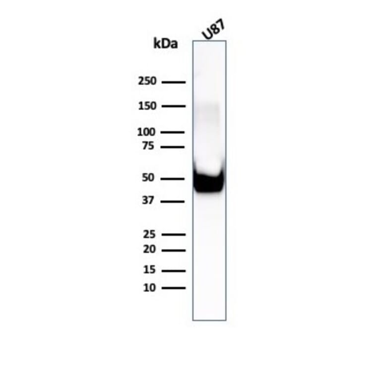 Western Blot - Anti-Vimentin Antibody [rVIM/6575] - BSA and Azide free (A253486) - Antibodies.com