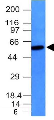 Western blot analysis of Raji cell lysate using Anti-Vimentin Antibody [VM452].