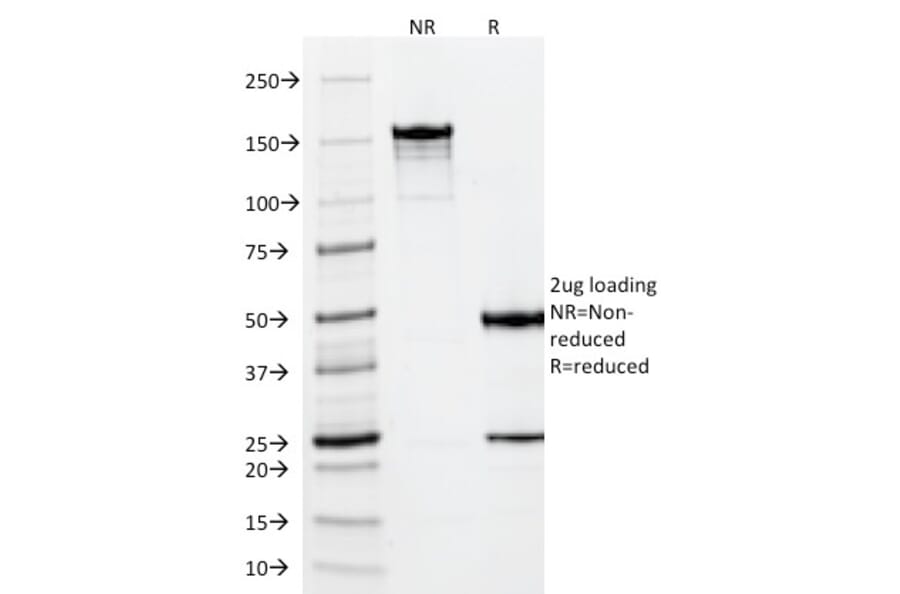 SDS-PAGE - Anti-Vimentin Antibody [VM452] - BSA and Azide free (A253487) - Antibodies.com