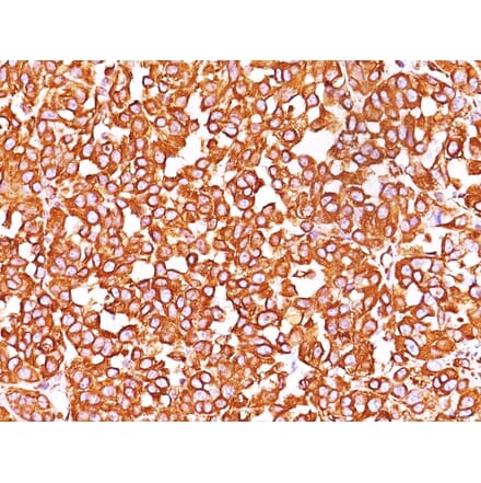 Immunohistochemistry - Anti-Vimentin Antibody [SPM576] - BSA and Azide free (A253487) - Antibodies.com