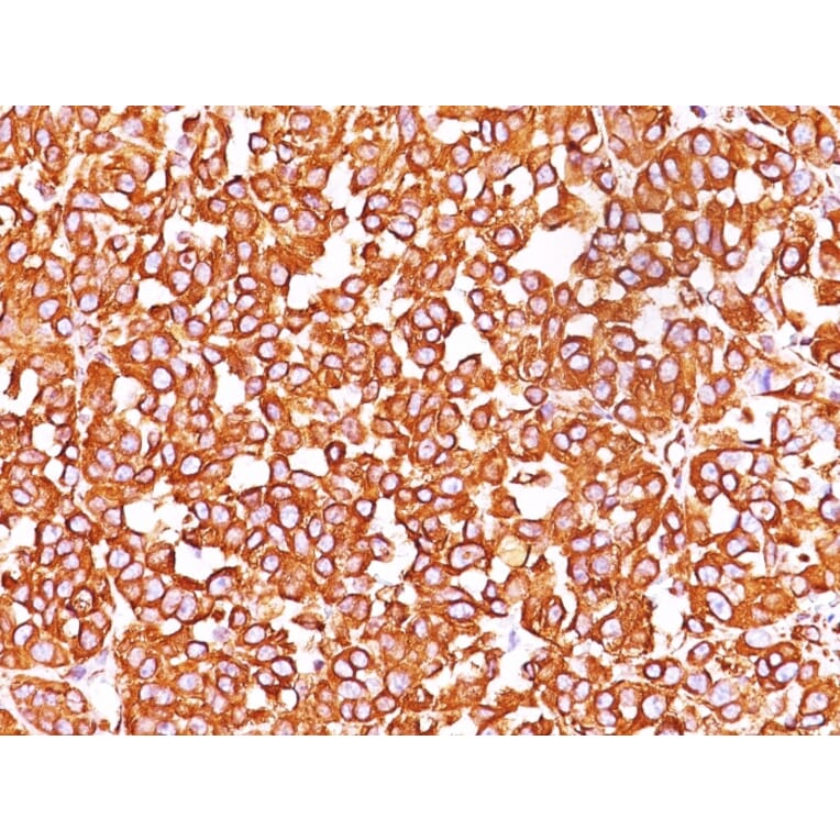 Immunohistochemistry - Anti-Vimentin Antibody [SPM576] - BSA and Azide free (A253487) - Antibodies.com
