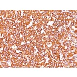Immunohistochemistry - Anti-Vimentin Antibody [SPM576] - BSA and Azide free (A253487) - Antibodies.com