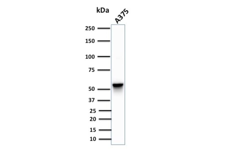 Western Blot - Anti-Vimentin Antibody [SPM576] - BSA and Azide free (A253488) - Antibodies.com