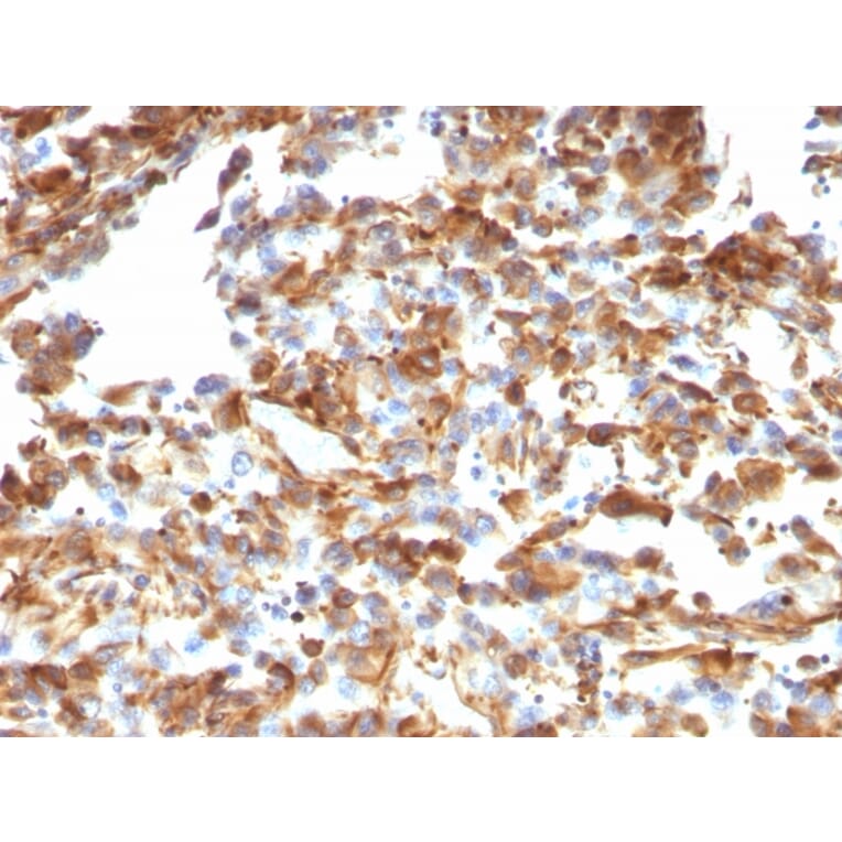 Immunohistochemistry - Anti-Vimentin Antibody [VM1170] - BSA and Azide free (A253489) - Antibodies.com