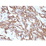 Immunohistochemistry - Anti-Vimentin Antibody [VM1170] - BSA and Azide free (A253488) - Antibodies.com