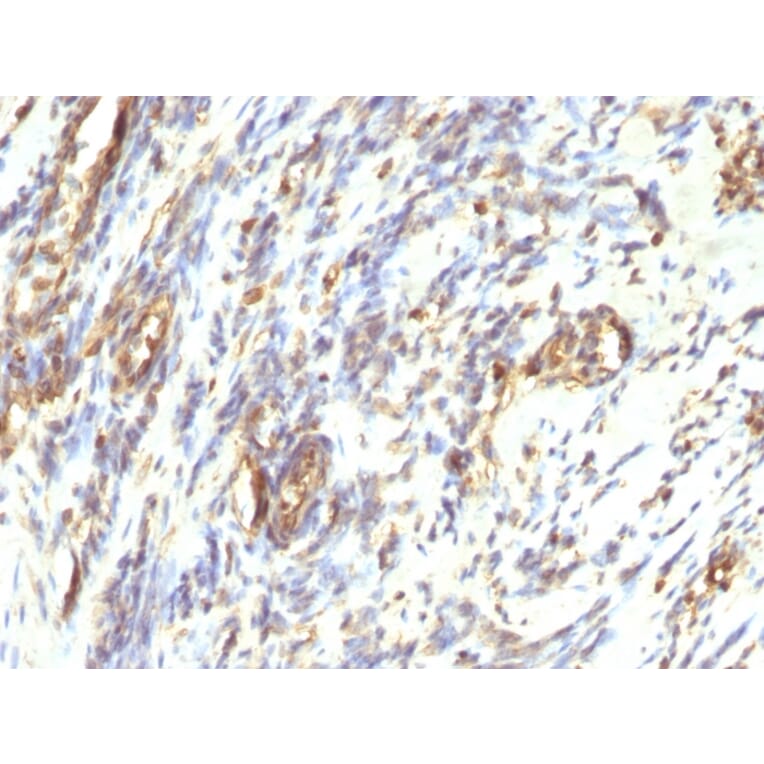 Immunohistochemistry - Anti-Vimentin Antibody [VM1170] - BSA and Azide free (A253489) - Antibodies.com