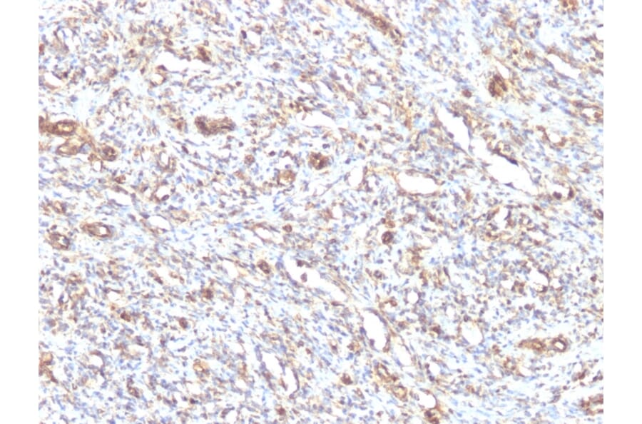Immunohistochemistry - Anti-Vimentin Antibody [VM1170] - BSA and Azide free (A253489) - Antibodies.com