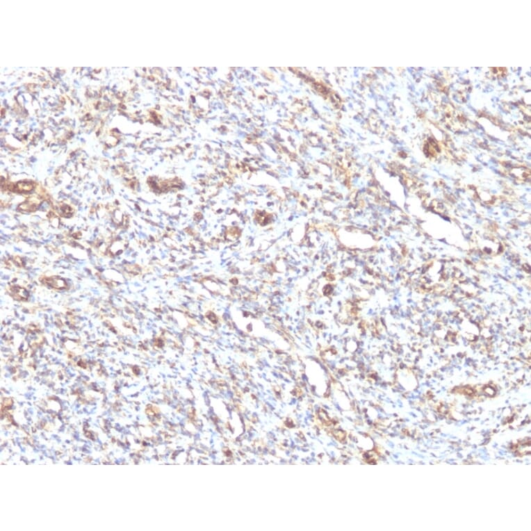 Immunohistochemistry - Anti-Vimentin Antibody [VM1170] - BSA and Azide free (A253489) - Antibodies.com