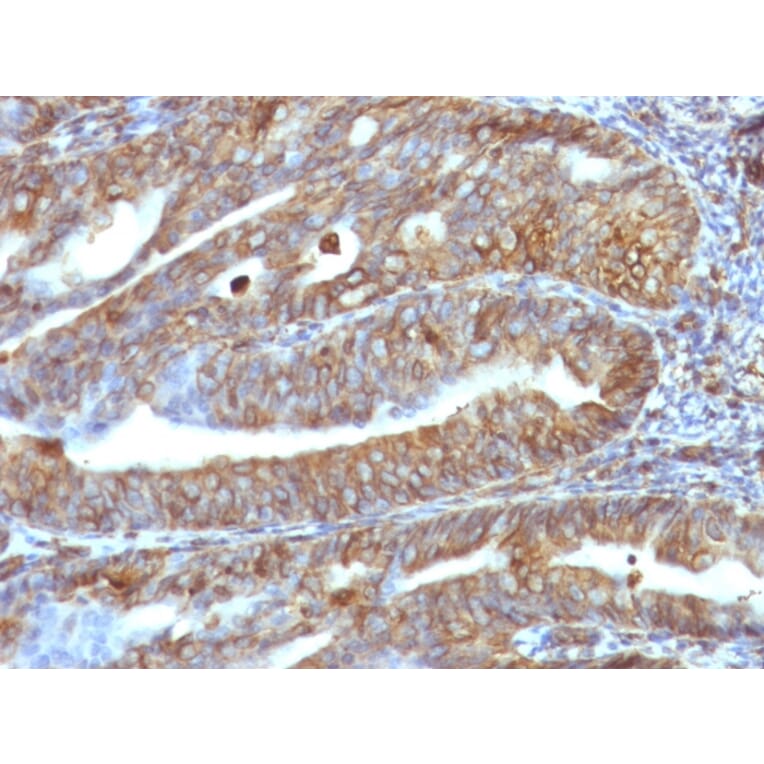 Immunohistochemistry - Anti-Vimentin Antibody [VM1170] - BSA and Azide free (A253489) - Antibodies.com