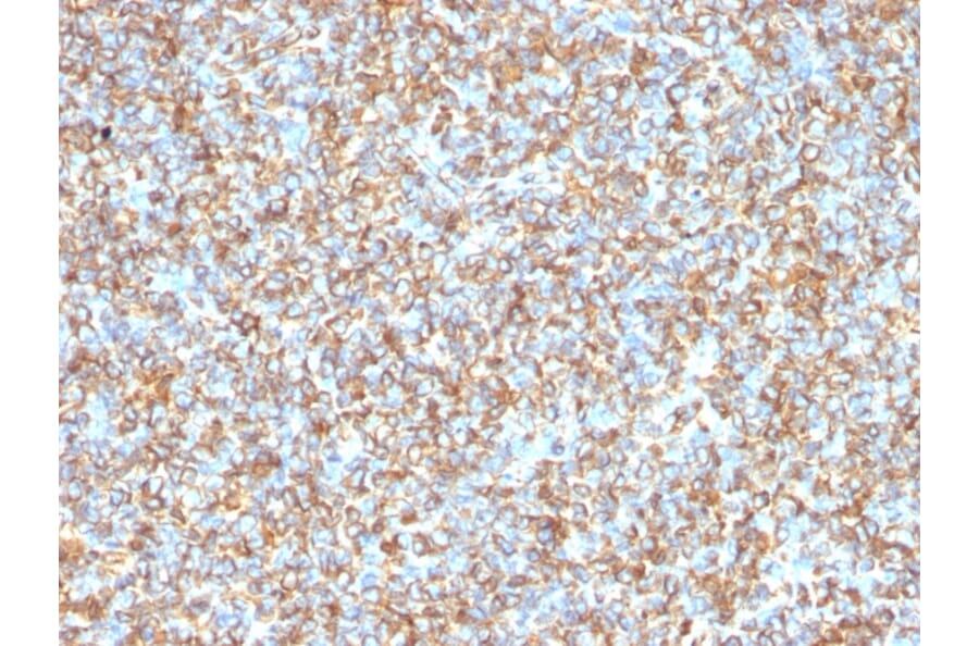 Immunohistochemistry - Anti-Vimentin Antibody [VM1170] - BSA and Azide free (A253489) - Antibodies.com