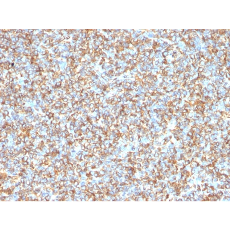 Immunohistochemistry - Anti-Vimentin Antibody [VM1170] - BSA and Azide free (A253489) - Antibodies.com