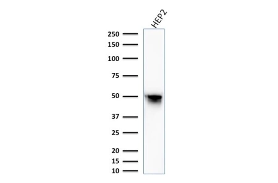 Western Blot - Anti-Vimentin Antibody [VM1170] - BSA and Azide free (A253489) - Antibodies.com
